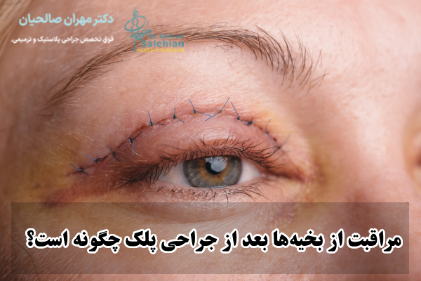 مراقبت از بخیه‌ها بعد از جراحی پلک چگونه است؟
