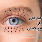 مراقبت های بعد از بلفاروپلاستی