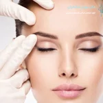 مراقبت‌های بعد از لیفت اندوسکوپی شقیقه