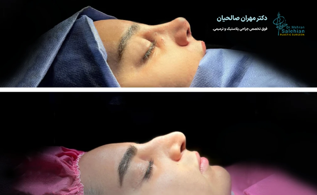 ساختار بینی استخوانی
