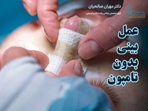 عمل بینی بدون تامپون