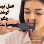 عمل بینی گوشتی چگونه است؟