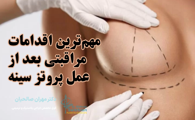 مهم‌ترین اقدامات مراقبتی بعد از عمل پروتز سینه