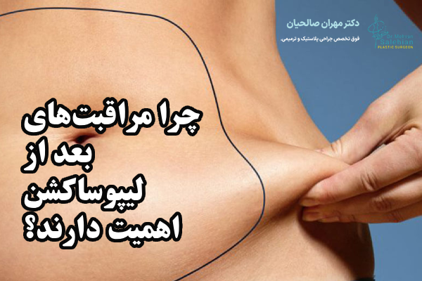 چرا مراقبت‌های بعد از لیپوساکشن اهمیت دارند؟