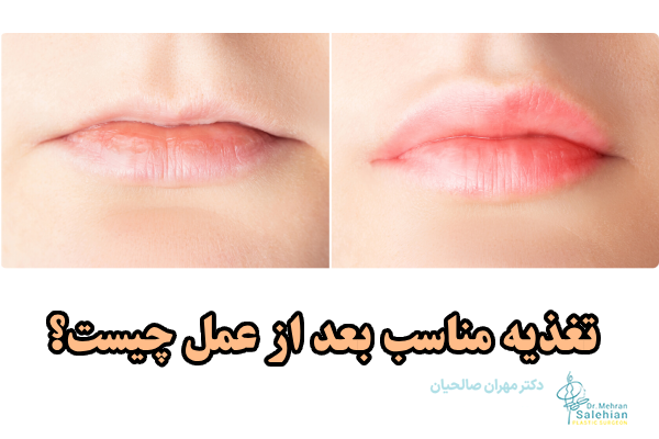 تغذیه مناسب بعد از عمل چیست؟