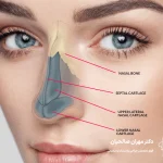 تفاوت جراحی بینی طبیعی با بینی فانتزی