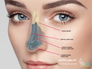 تفاوت جراحی بینی طبیعی با بینی فانتزی