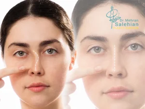 جراحی ترمیمی بینی