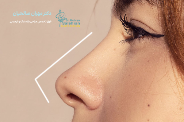 در چه شرایطی می‌توان عمل بینی زیر ۱۸ سال انجام داد؟