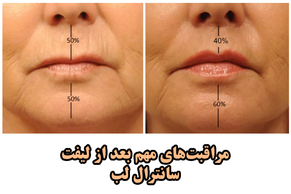 روزهای اولیه بعد از سانترال لب