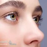 عمل بینی زیر 18 سال