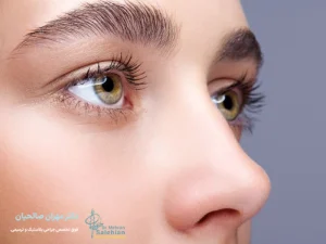 عمل بینی زیر 18 سال