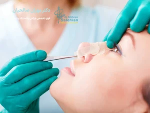 عمل بینی غضروفی