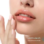 مراقبت‌های بعد از لیفت سانترال لب