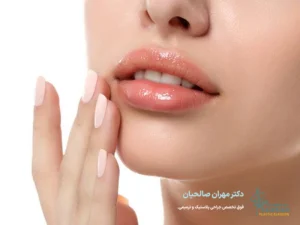مراقبت‌های بعد از لیفت سانترال لب