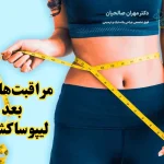 مراقبت‌های بعد از لیپوساکشن
