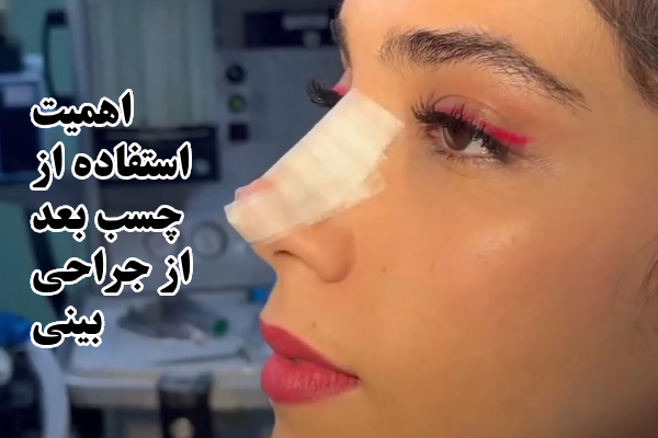 نحوه صحیح چسب زدن بینی بعد از جراحی