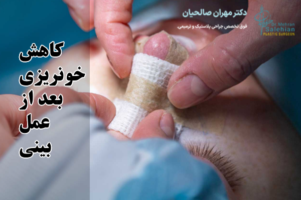 تغذیه بعد از عمل بینی چه تاثیری در خونریزی دارد؟