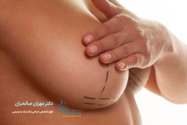 لیفت سینه چیست؟