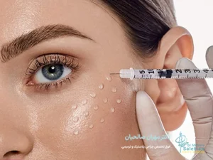 مزوتراپی پوست: پیشگیری از چین و چروک‌ها!